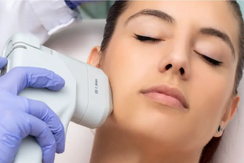 Discover the Perfect Duo: RF Microneedling and HIFU 2 Image of Morpheus8 And HIFU Combined with Lipo 360 Swindon